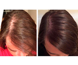 Win-a-free-sample-of-MONAT’s-RENEW-Shampoo
